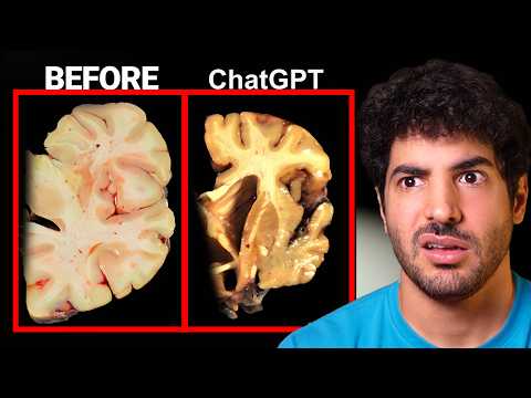 It's Official: ChatGPT is Making You Dumb サムネイル