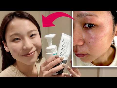 【絶望肌から大逆転】守りのスキンケア紹介｜乾燥肌・敏感肌・アトピー サムネイル